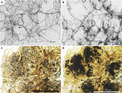 Accumulation of Abnormal Amyloplasts in Pulp Cells Induces Bitter Pit in Malus domestica